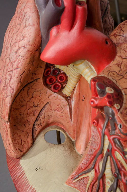 Picture of Lung Medical Model