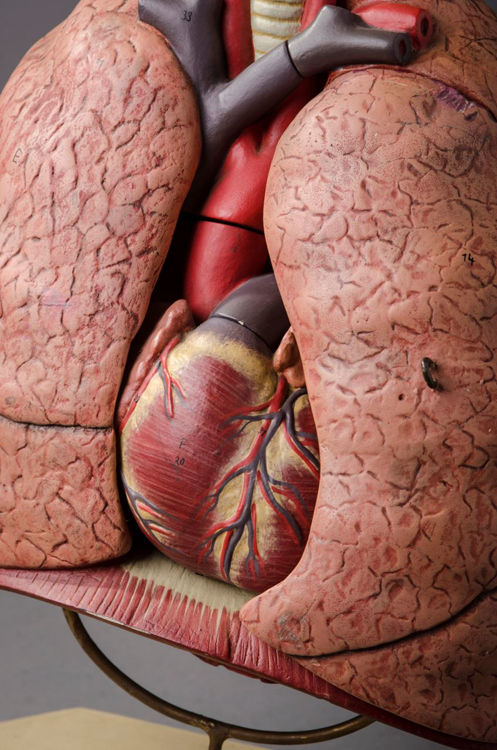 Picture of Lung Medical Model