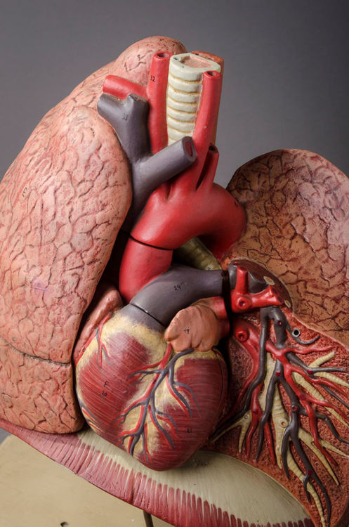 Picture of Lung Medical Model