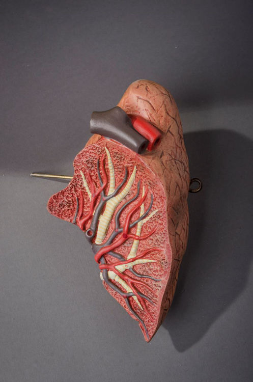 Picture of Lung Medical Model