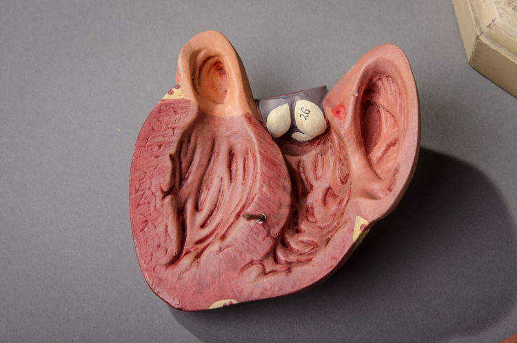 Picture of Lung Medical Model