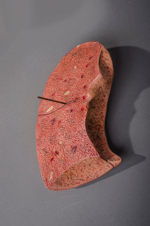 Picture of Lung Medical Model