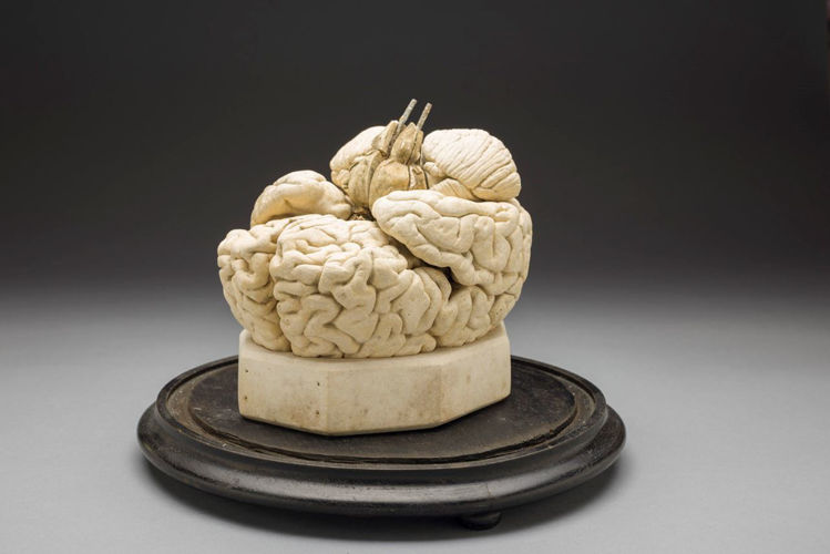 Picture of Brain Medical Model