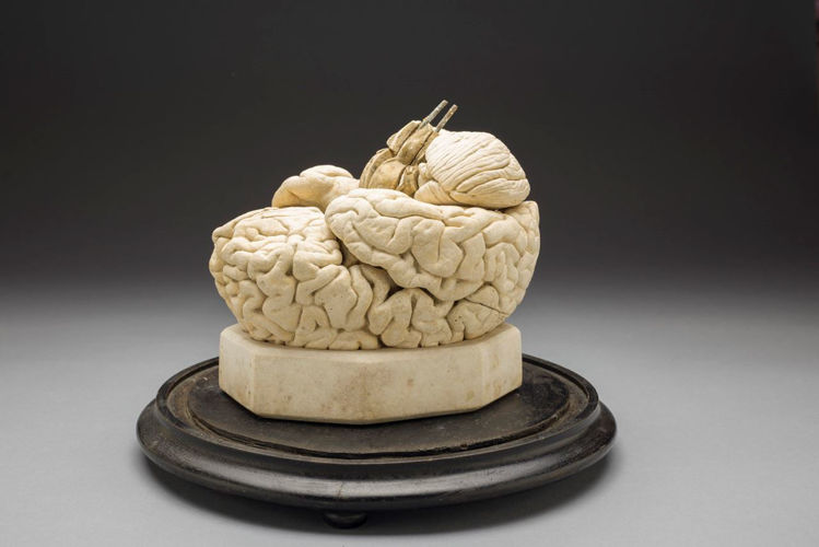 Picture of Brain Medical Model