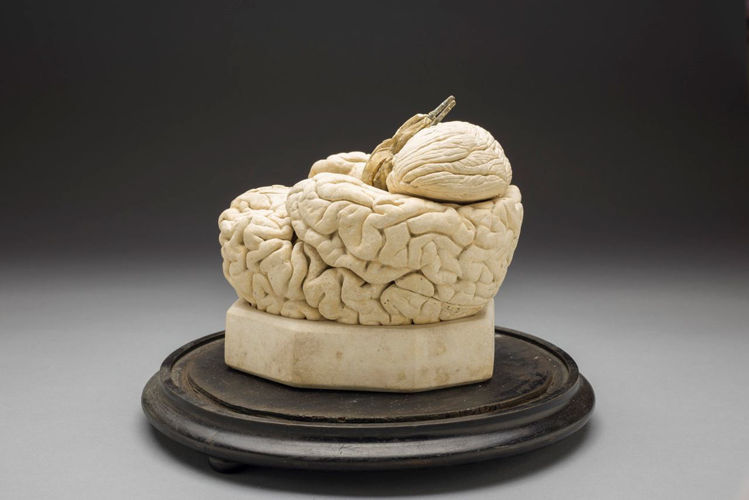 Picture of Brain Medical Model