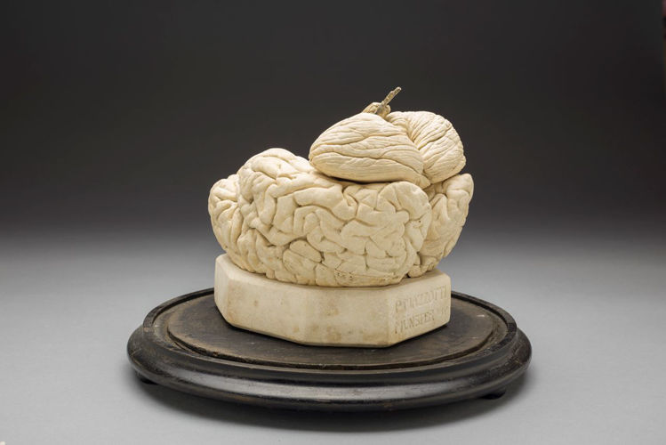 Picture of Brain Medical Model