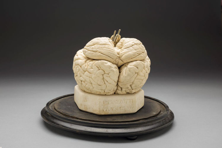 Picture of Brain Medical Model