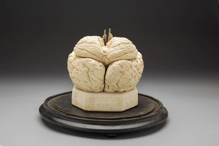 Picture of Brain Medical Model