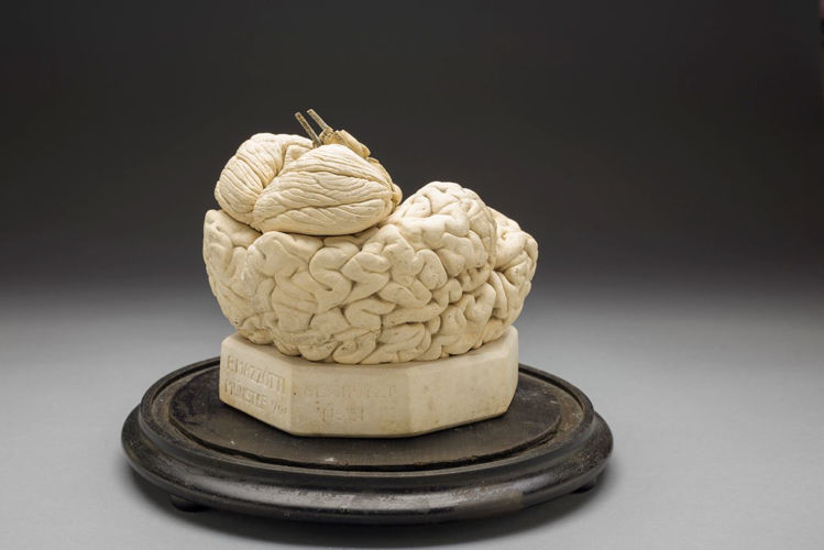 Picture of Brain Medical Model