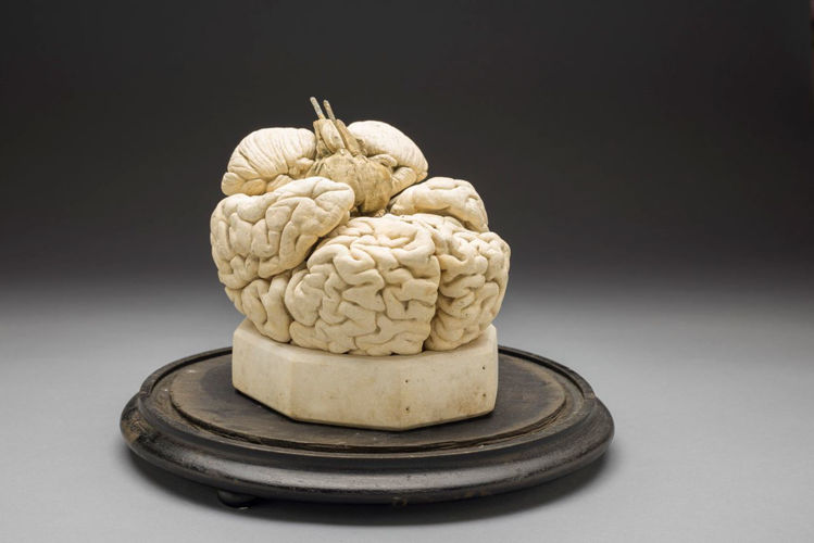 Picture of Brain Medical Model