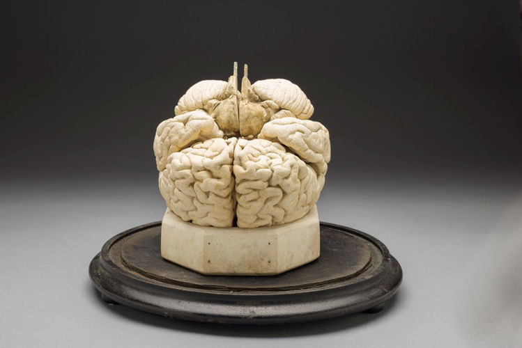 Picture of Brain Medical Model