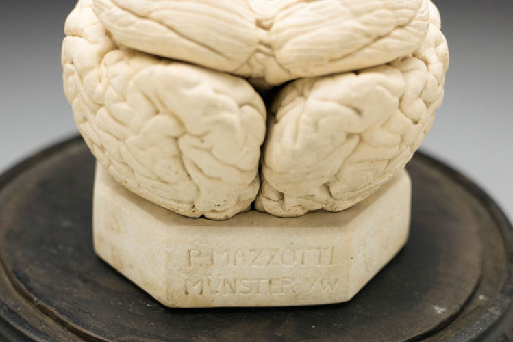 Picture of Brain Medical Model