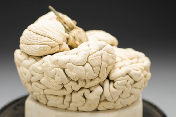 Picture of Brain Medical Model