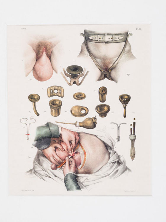 Picture of Medical Reproductive Anatomy Drawing