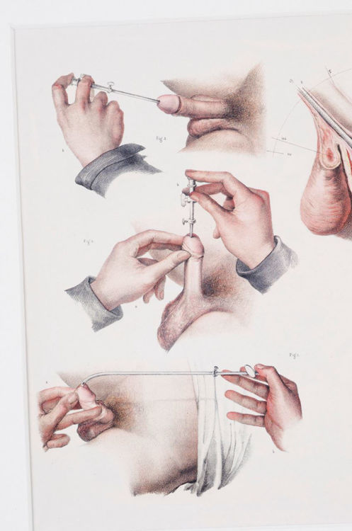 Picture of Medical Reproductive Anatomy Drawing