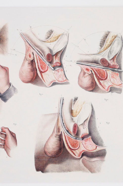 Picture of Medical Reproductive Anatomy Drawing