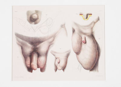 Picture of Medical Reproductive Anatomy Drawing