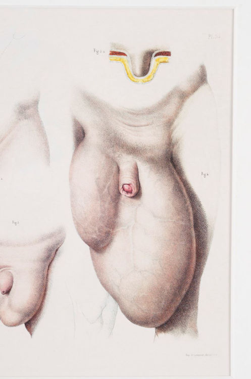 Picture of Medical Reproductive Anatomy Drawing