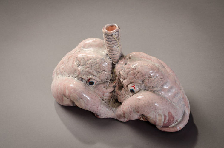 Picture of Lungs