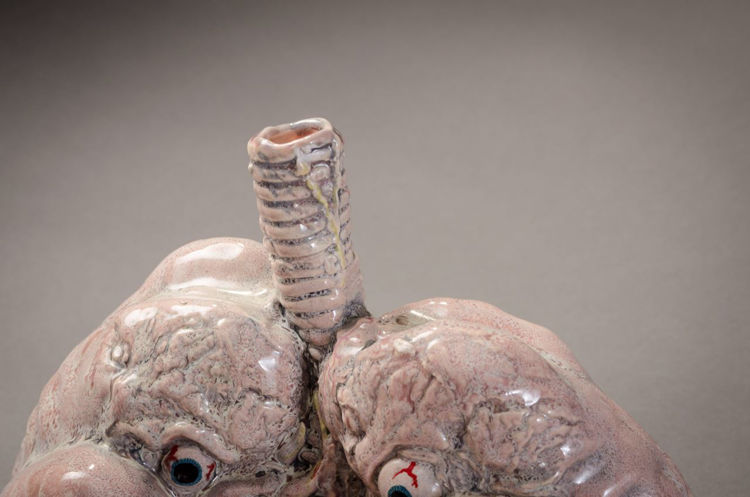 Picture of Lungs